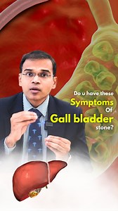 Do u have these symptoms Of Gall bladder stone? Check for these signs of gall bladder stones: sudden intense pain in the abdomen, nausea, and jaundice. Don't let it 'stone' you, seek medical help ASAP! 🏥 #GallBladderProblems #ListenToYourBody #StayHealthy" | The Ashok Doctor