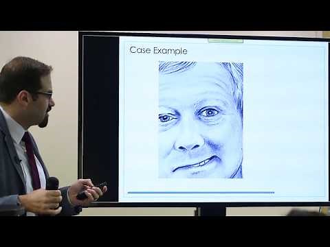 Stroke VAN with Dr Mohamed Teleb