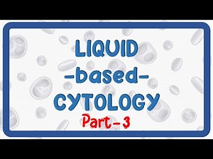 SurePath in Liquid-Based Cytology Part-3 | Comparison with ThinPrep for Pathologists