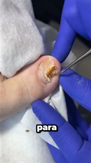 Would you like to learn aesthetic pedicure, foot spa, and onychocryptosis techniques? 👣