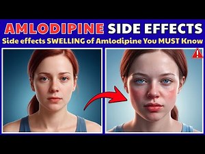 Amlodipine Swelling in Feet & Ankles (Hidden Cause & Quick Fix)
