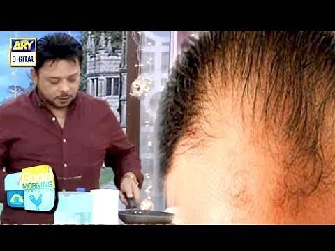 Ganjapan Ka Aasan Desi Ilaj, Janiye Dr Essa Se