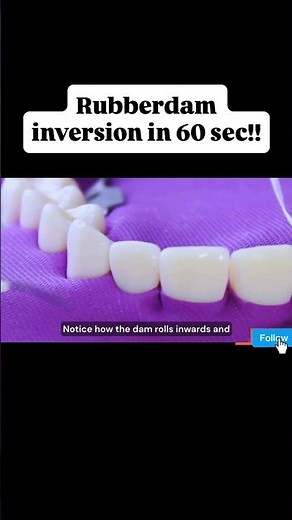 Rubber Dam Inversion | Step-by-Step Dental Tutorial #shorts #dentist