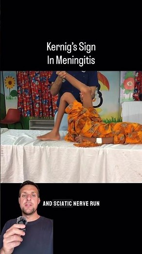 Kernig’s sign in meningitis