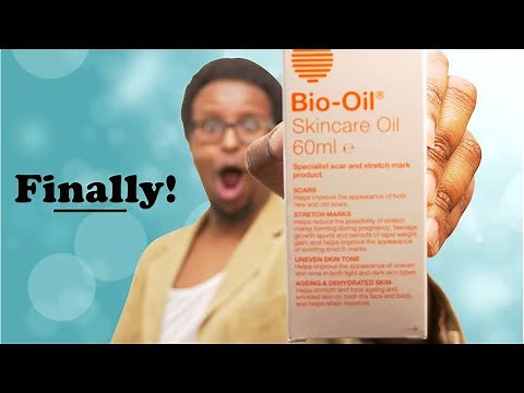 Bio-oil Review | what i found after trying it for 2 weeks
