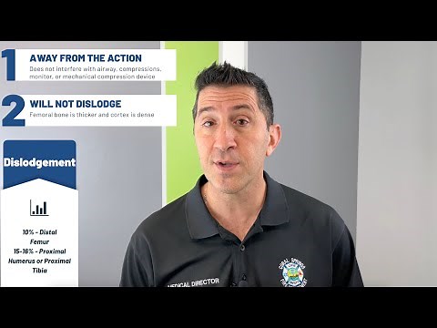 Distal Femur IO in Adults