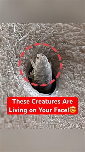 The Mites You Didn’t Know You Had