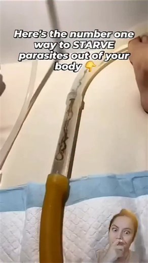 Danica on Instagram: "PARASITE STARVING SECRET🪱👇 Parasites and heavy metals such as lead, mercury & arsenic almost ALWAYS go hand in hand. It is well known amongst naturopaths and functional doctors that if you have parasites, you also have heavy metal toxicity. There have been several papers published revealing that some parasites actually use heavy metals as a food source. "Some parasites can eat 5 to 6x their body weight in metals" Parasites also use heavy metals to coat themselves with a b