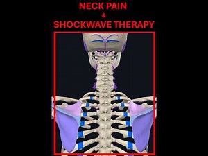 Fast Neck Pain Relief: A Comprehensive Look at the Power of Shockwave EMTT Therapy BY STORZ MEDICAL