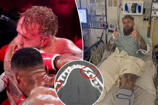 Jake Paul reveals jarring extent of jaw injury after post-fight surgery