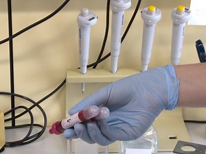 Isolation and Characterization of Microvesicles from Peripheral Blood