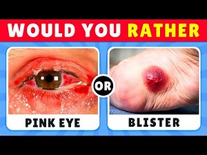 Would You Rather…? 100 EXTREME Questions That’ll BREAK Your Brain! 😱🔥 | Quiz Spark Challenge