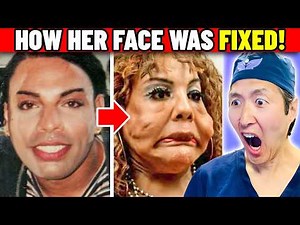 Her Face is Filled with Cement and Fix-a-Flat! EXTREME Bodies Explained!