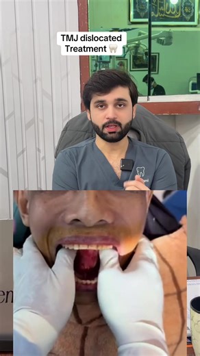 Effective Treatment for Dislocated TMJ