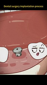 155K views · 831 reactions | #tooth #teeth #dental #surgery #implantation #foryou #fypシ #sciencefacts #mathematics#physics#life #subject #science #quantumphysics, #fyp #foryou #tiktok #lnteresting#science#physics | Sience | Facebook