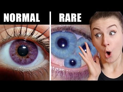 Top 10 Rarest Eye Colors Only Humans Have