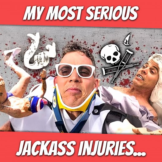 268K views · 5.9K reactions | My Most Serious Jackass Injuries | Steve-O | Facebook