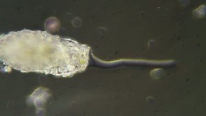 Difflugia pyriformis, cousin de D. globulosa | Canal U