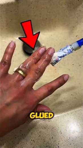 Super Glue on Your Fingers? NEVER Use Water First!