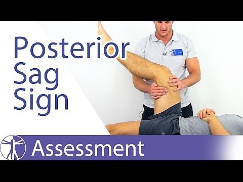Posterior Sag Sign | Cruciate Ligament Tear