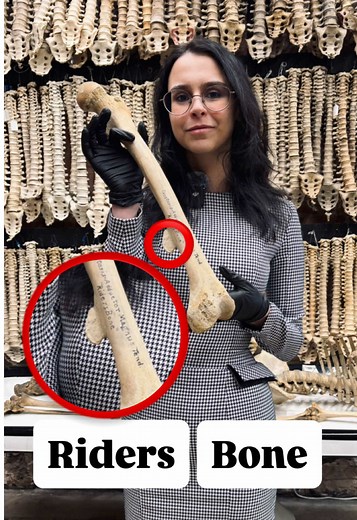 🎄 A little bone science as a holiday treat 🎄 One of our fan-favorite surprises is back: rider’s bone, a bony exostosis that can form on the femur in long-term equestrians. Repetitive gripping of the saddle, sustained hip adduction, and constant muscle pull where the adductors attach can stimulate the periosteum to lay down extra bone over time. It’s a perfect reminder that bones aren’t static, they respond to how we use our bodies. Just like tennis elbow or pitcher’s shoulder, equestrian sport