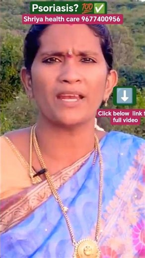 Psoriasis? 💯✅ #shorts #viral #trending #health #psoriasis #skinproblems #skin #healthcare #tamil
