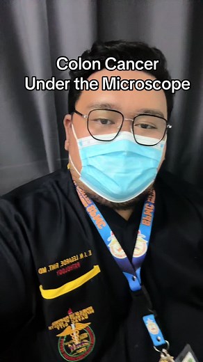 Understanding Colon Cancer Through Histopathology