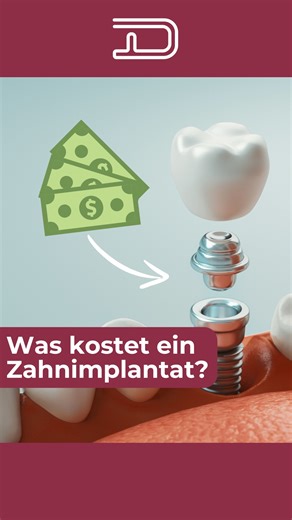 Was kostet ein Zahnimplantat?🤔 Die Kosten für ein Zahnimplantat hängen von verschiedenen Faktoren ab – doch eines ist sicher: Eine Investition in feste Zähne ist eine Investition in deine Lebensqualität! Wir erklären, wovon die Preise abhängen und warum hochwertige Implantate langfristig die beste Lösung sind. Wenn du noch Fragen hast, schreib sie uns gerne in die Kommentare! #Zahnimplantate #FesteZähne #LächelnFürsLeben #Dentaprime | Dentaprime