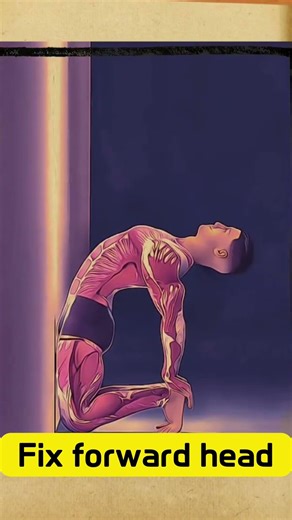 Fix forward head posture correction #forwardheadposture #posturecorrection