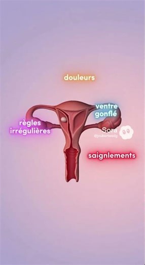 Fibromes c’est quoi ?