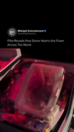 Midnight Entertainment on Instagram: "interesting 🫀 Donor hearts are flown across the world through a tightly coordinated, time-critical process designed to keep the organ alive and safe. Once a heart is donated, surgeons carefully remove it and place it in a sterile container surrounded by a cold preservation solution, which slows cellular damage and buys a limited window of time—usually about four to six hours. From there, transplant teams and logistics coordinators move fast, using ambulance