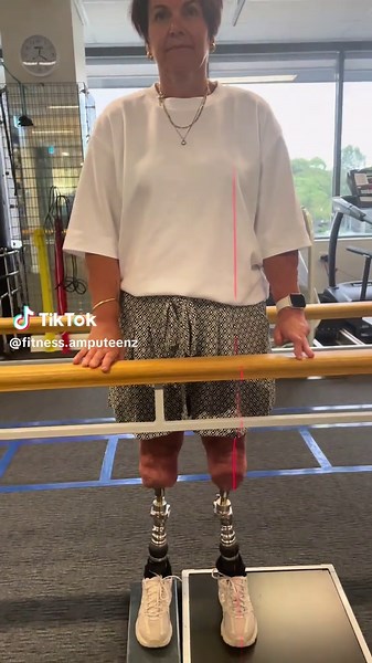 Laser Alignment for Mobility: Amputee Osseointegration Surgery