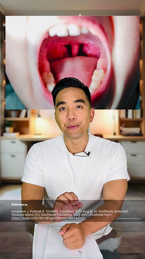 Understanding Tonsils: Symptoms and Home Remedies