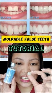 Moldable False/Temporary Teeth ://s.lazada.comTutorial Paano Gawin at Gamitin. Price Check Here🛒 LαZ🛒https://s.lazada.com.ph/s.iLeeO?cc Sh0p€e🛒https://shope.ee/6pZI3quKIq | Jhenna Cariñosa