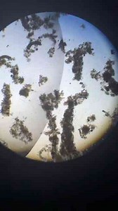 Incredible Microscopic World Revealed