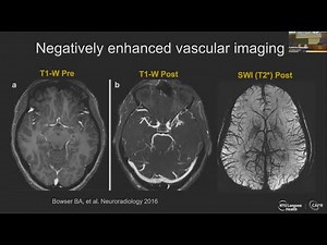 Scientific Session VII: Head and Neck MRA