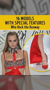 18K views · 40 reactions | 16 Models With Special Features Who Rock the Runway | Bright Side of Love | Facebook