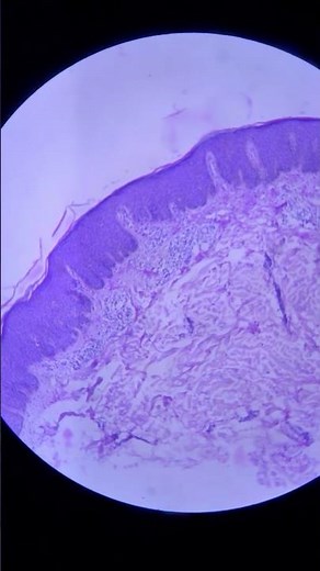 Zooming into skin layers 🔎 #histopathology #pathology #dermatology