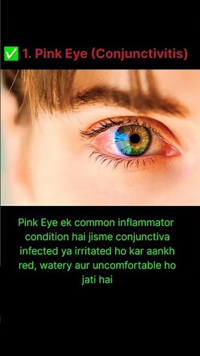 👉 Pink Eye (Conjunctivitis) Explained | Causes, Symptoms & Treatment | Doctor’s Science Talk #eyes