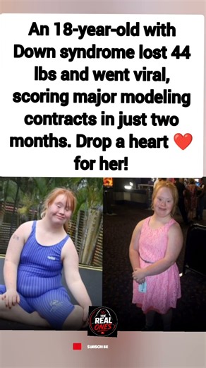18-Year-Old with Down Syndrome Becomes a Viral Model!#shorts#viral#trending#trendingshorts