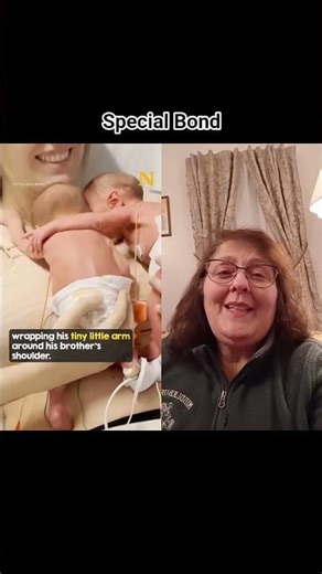 Twins Special Bond #shorts