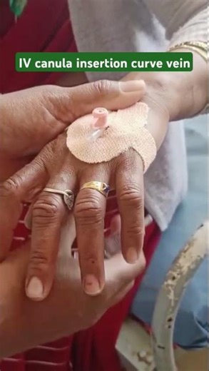 IV canula insertion #Pink canula#injection