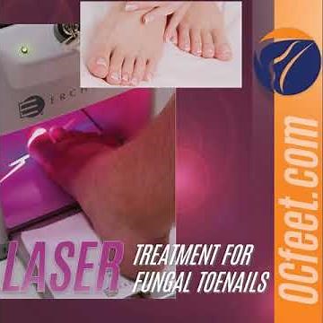 Lunula Laser - Toenail Fungus Therapy