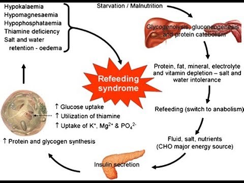 Refeeding Syndrome; nutrition is reintroduced too rapidly in malnourished or starved
