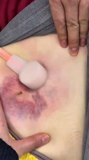 Unlocking Bone Health: Revolutionizing Physiotherapy Techniques in Shanghai