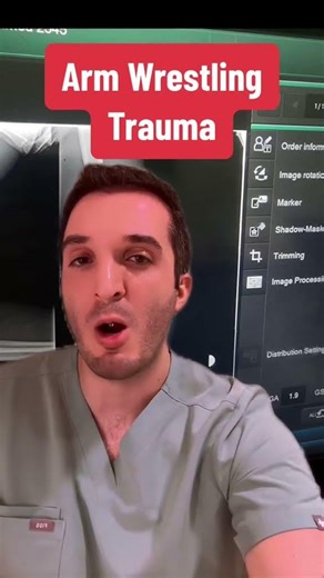 Arm Wrestling Trauma - humerus fracture on x-ray