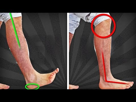 Fix Your Walk and Avoid Limping in 5 Minutes