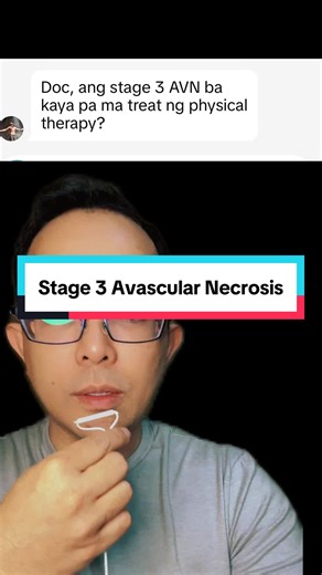 Stage 3 Avascular Necrosis