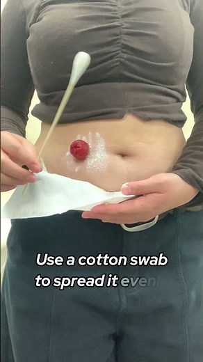 Using stoma powder—simple guide！