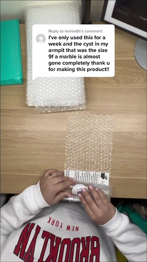 Natural Remedies for Healing Underarm Cysts